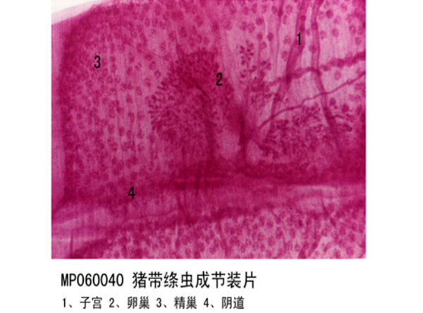 豬帶絳蟲(chóng)成節(jié)裝片